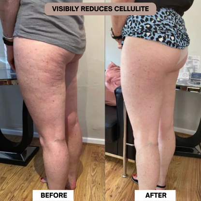 CELLULITE RELIEF BODY MASSAGER