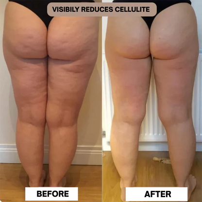 CELLULITE RELIEF BODY MASSAGER